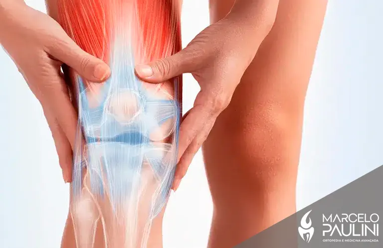 Dor no joelho, o que pode ser? Descubra quando é hora de buscar o ortopedista especialista