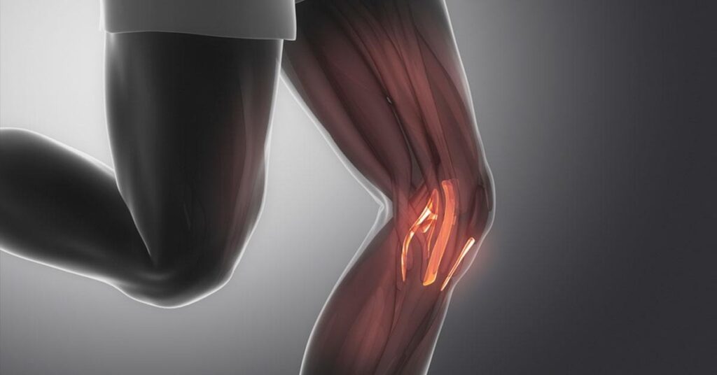 Sintomas de ligamento rompido: 5 sinais que você deve ficar atento