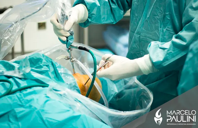 Como é feita a cirurgia de artroscopia do joelho