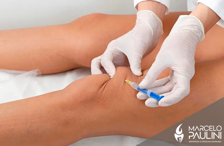 Para que serve a aplicação de ácido hialurônico no joelho?